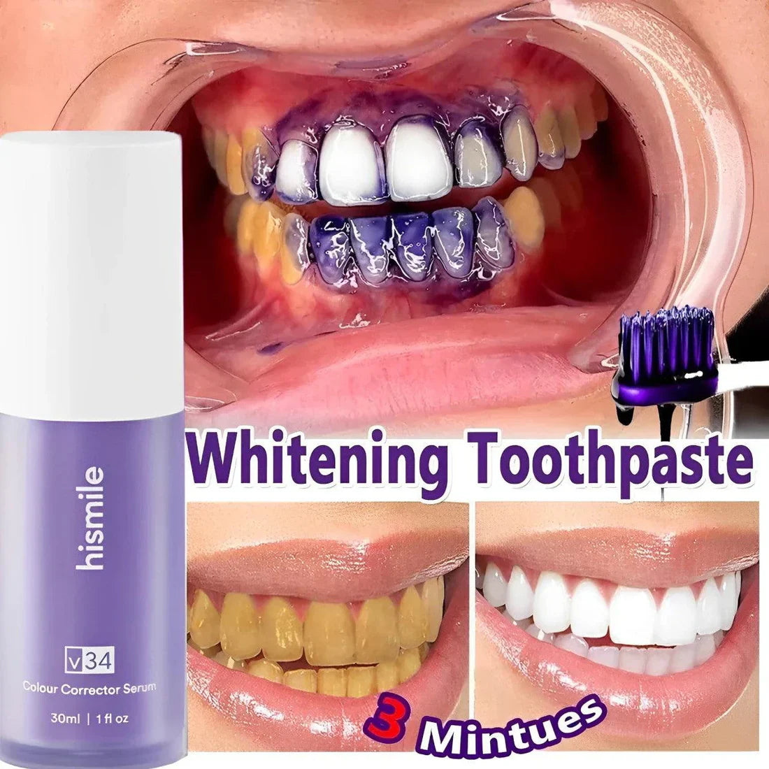Hi Smile - Brighten Your Teeth Safely